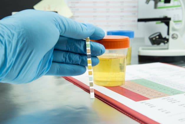 xét nghiệm nước tiểu được sử dụng phổ biến góp phần đưa ra chẩn đoán sàng lọc bệnh