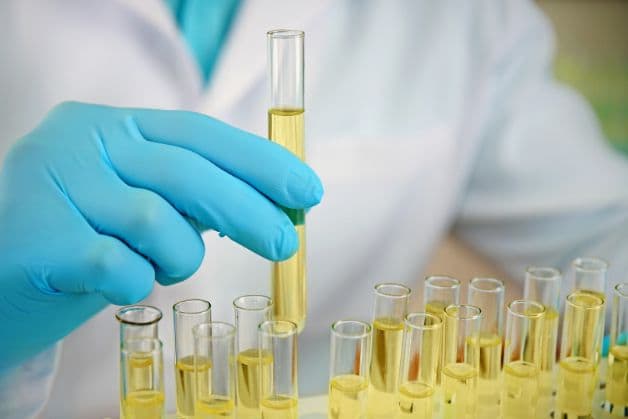 Xét nghiệm nước tiểu 10 thông số là chỉ định cần thiết trong chẩn đoán và điều trị các bệnh lý