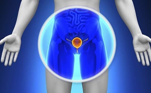 Chỉ số PSA có thể cảnh báo bệnh lý ung thư tuyến tiền liệt