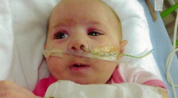 5 – 10% trẻ sơ sinh nhiễm bệnh sống trong một năm