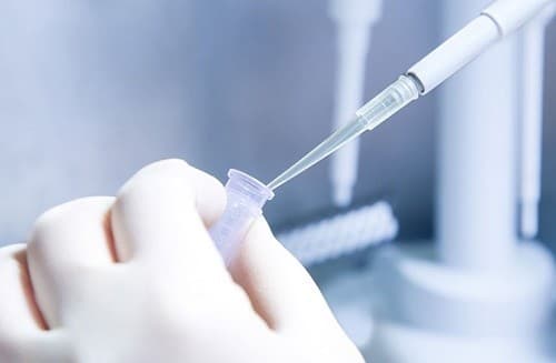 Bạn nên đến các cơ sở y tế uy tín để làm xét nghiệm HPV định type để biết chính xác mình bị nhiễm loại HPV nào.