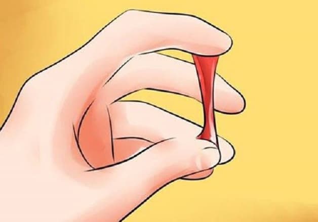 Kinh nguyệt lẫn chất nhày là hiện tượng khiến nhiều chị em lo lắng