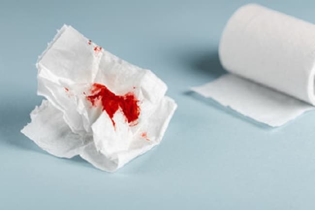 Trên thực tế, có khoảng 50% trường hợp các chị em mang thai 4 tuần bị ra máu.