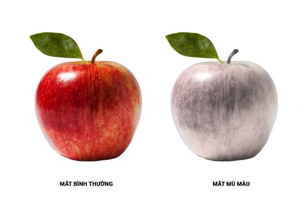 mù màu có chữa được không