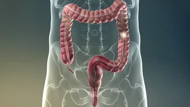 Tìm hiểu nội soi đại tràng có khó chịu không?