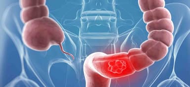 Thông tin cơ bản về xét nghiệm ca 72-4