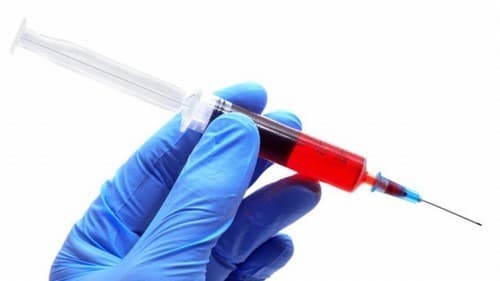 Xét nghiệm định lượng virus viêm gan C cần thiết trong chẩn đoán và theo dõi điều trị bệnh