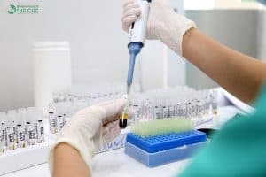 xét nghiệm ca 72-4 cũng được sử dụng để theo dõi việc đáp ứng điều trị của bệnh nhân ung thư