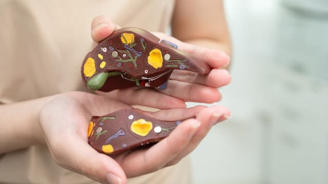 Gan nhiễm mỡ có nguy hiểm không?