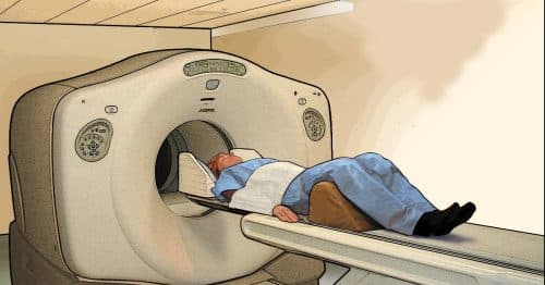 Chụp PET CT có hại không? Cần phải làm gì trước khi chụp PET/CT 1