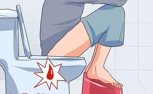 Đi cầu ra máu tươi là bệnh gì?