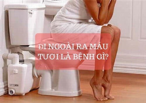 Thăm khám để được chẩn đoán chính xác đi ngoài ra máu là bệnh gì và điều trị kịp thời