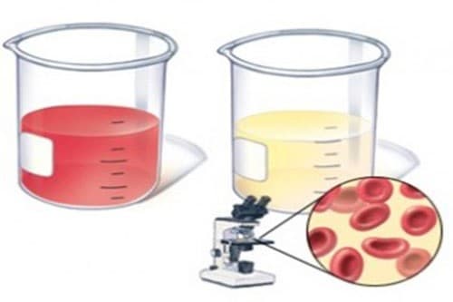 Đi tiểu ra máu có thể là dấu hiệu của nhiều bệnh lý nguy hiểm