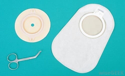 hau mon nhan tao la gi