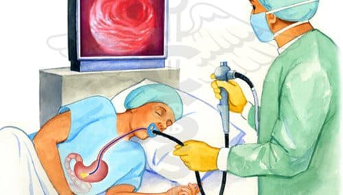 Nếu nghi ngờ mắc bệnh ở dạ dày, người bệnh có thể được chỉ định nội soi để xác định tổn thương bên trong dạ dày như viêm loét dạ dày hoặc đau dạ dày do sự tồn tại vi khuẩn HP.