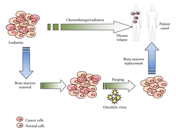 Hóa trị là gì? Bệnh Viện ĐKQT Thu Cúc