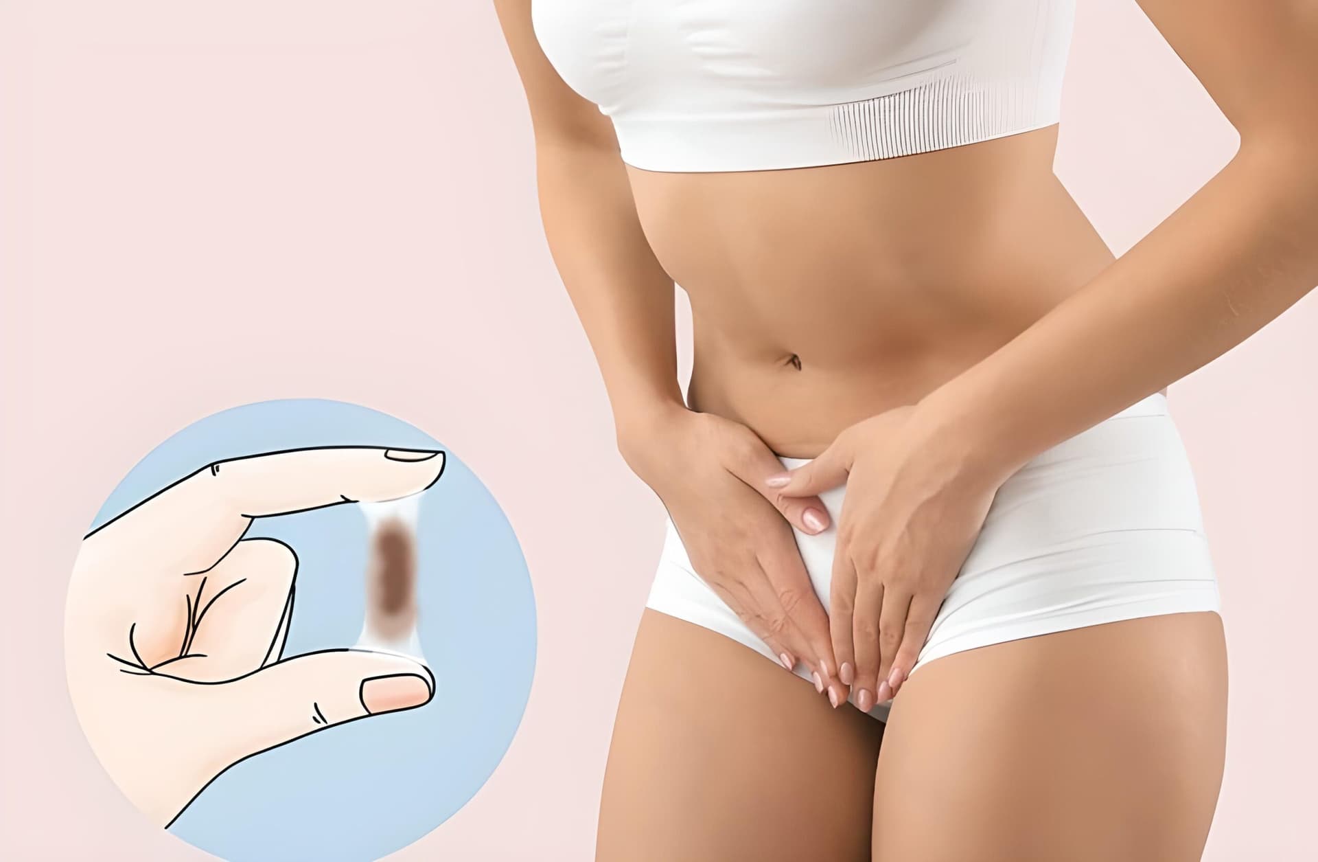 Khí hư âm đạo màu nâu có thể là biểu hiện của nhiều bệnh phụ khoa 