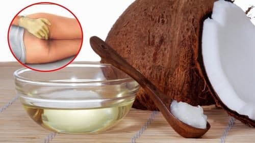 Mẹo chữa bệnh trĩ bằng dầu dừa là một phương pháp được nhiều người truyền tai nhau sử dụng. 