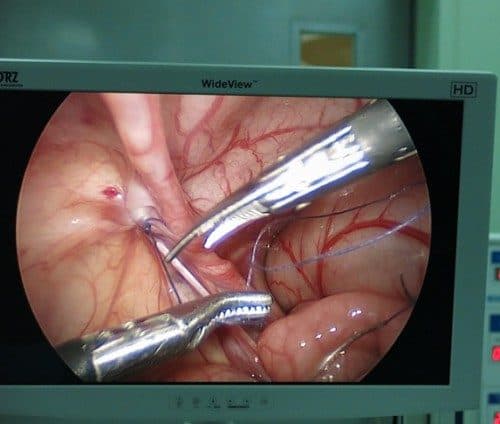 Mổ nội soi là phương pháp hiện đại được áp dụng trong việc điều trị các bệnh lý về tiêu hóa, tim mạch, sản, tai -mũi - họng...