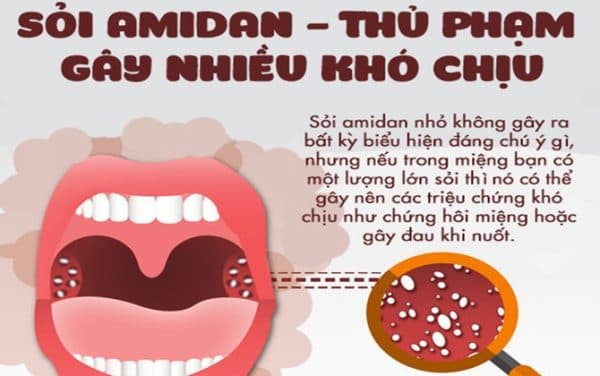 Đau cổ họng bên trái là do đâu?