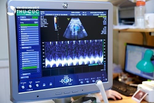 emstrongKhi thai 12 tuần, mẹ bầu đã có thể nghe thấy nhịp tim của bé một cách rõ ràng/strong/em