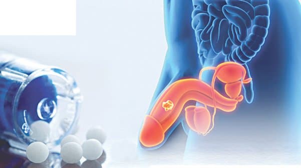 Tiên lượng sống của bệnh nhân ung thư dương vật 