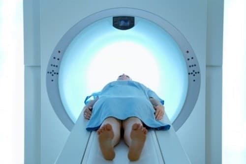 Ung thư hạch bạch huyết là gì