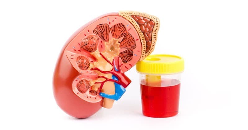 Đi tiểu ra máu là bệnh lý gì?