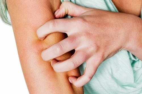 Ngứa trên da có thể là dấu hiệu cảnh báo bệnh tiểu đường