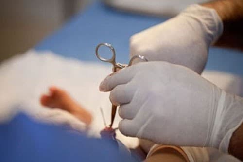 cat-bao-quy-dau-lam-gi-1