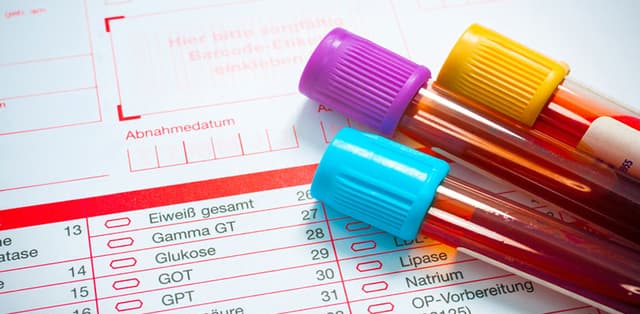 Chỉ số ggt bao nhiêu là cao? Chỉ số GGT tăng cảnh báo bệnh gì?