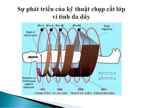 Chụp Cắt Lớp là gì? Tác dụng của chụp cắt lớp vi tính 2