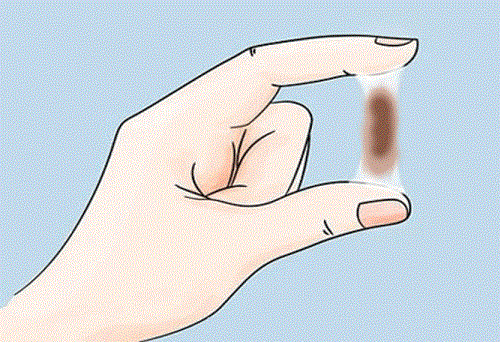 co-thai-ra-khi-hu-mau-nau-la-do-dau-1