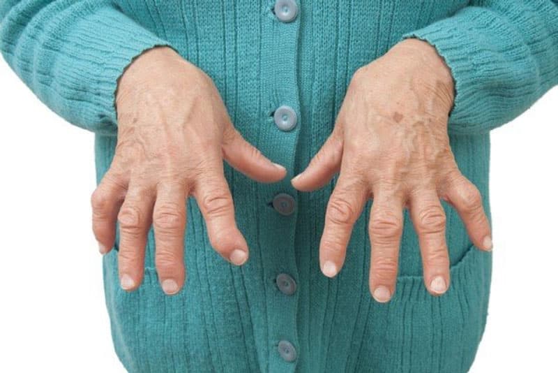 Đau, sưng các khớp là biểu hiện điển hình khi ung thư tuyến giáp di căn xương