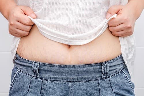 Dù ảnh hưởng thẩm mỹ, những bà mẹ đã từng sinh con cũng sẽ rất tự hào với chiếc bụng 