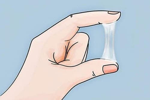 Khí hư là gì không phải chị em nào cũng biết