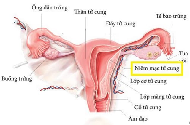 Niêm mạc tử cung là gì? Có ảnh hưởng gì tới quá trình