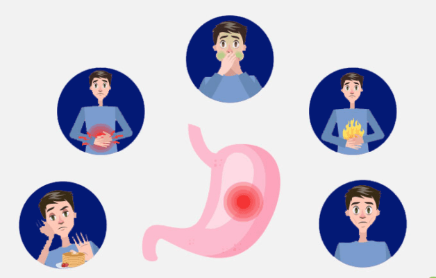 Tìm hiểu các triệu chứng bệnh ung thư dạ dày