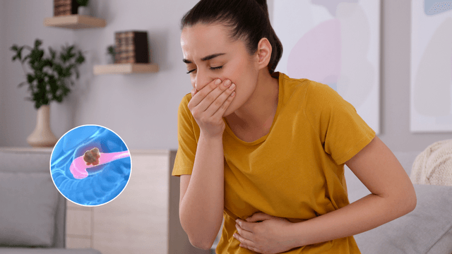 Triệu chứng ung thư tuyến tụy giai đoạn IV