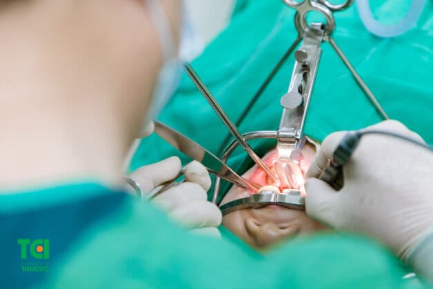 Trẻ bị viêm VA có thể sẽ được chỉ định nạo VA