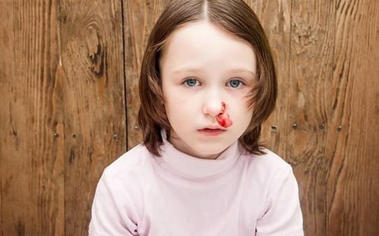 chay-mau-cam-thuong-xuyen-3