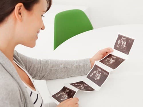 Có thai bao lâu thì siêu âm được là thắc mắc của nhiều chị em. 