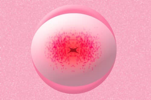 Ở cấp độ 3, tình trạng viêm nhiễm chiếm toàn bộ cổ tử cung. Ở cấp độ 3, tình trạng viêm nhiễm chiếm toàn bộ cổ tử cung. 