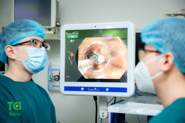 Điều trị polyp dạ dày