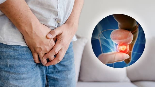 Ung thư tuyến tiền liệt giai đoạn 2 có chữa khỏi không?