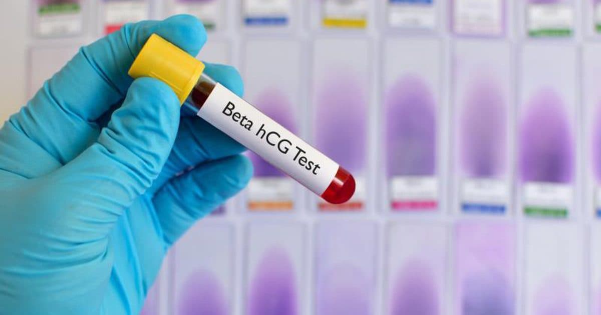 Xét nghiệm beta hcg hết bao nhiêu tiền?