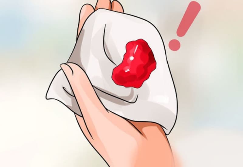 Máu trong phân cảnh báo nhiều bệnh lý