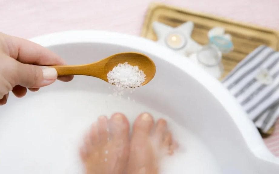 chữa chín mé bằng muối epsom