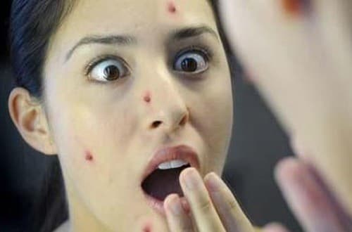 Triệu chứng cảnh báo cơ thể bạn nhiễm độc