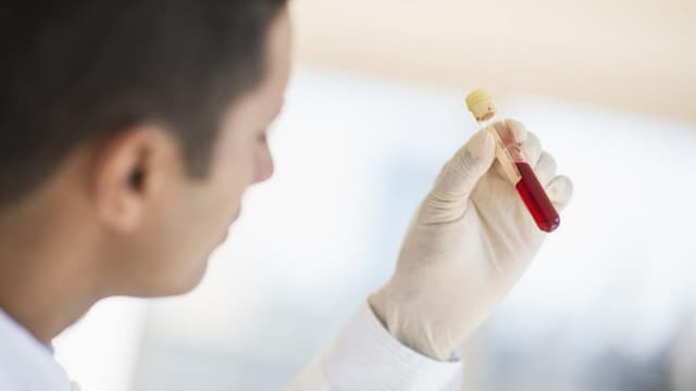 Chỉ số CA 125 cao phải làm sao?